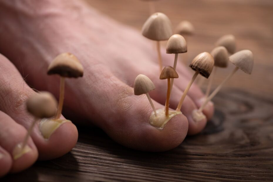 Fungos nas unhas: cuidados simples que fazem toda a diferença